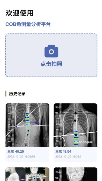 cobb角测量截图